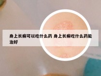 身上长癣可以吃什么药 身上长癣吃什么药能治好