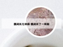 腰间长几块癣 腰间长了一块癣