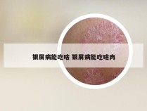 银屑病能吃啥 银屑病能吃啥肉