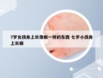 7岁女孩身上长像癣一样的东西 七岁小孩身上长癣