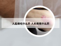 人起癣吃什么药 人长癣用什么药