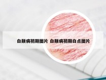 白颠病初期图片 白颠病初期白点图片