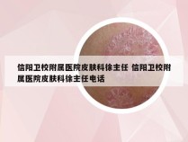 信阳卫校附属医院皮肤科徐主任 信阳卫校附属医院皮肤科徐主任电话