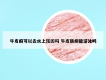 牛皮癣可以去水上乐园吗 牛皮肤癣能游泳吗