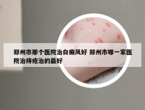 郑州市那个医院治白癜风好 郑州市哪一家医院治痔疮治的最好