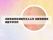 成都银康银屑病医院怎么么样 成都银康银屑病医学研究院