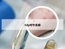 tdp对牛皮癣