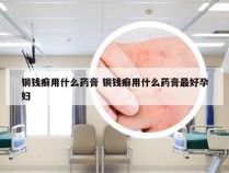 铜钱癣用什么药膏 铜钱癣用什么药膏最好孕妇