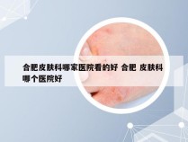 合肥皮肤科哪家医院看的好 合肥 皮肤科 哪个医院好