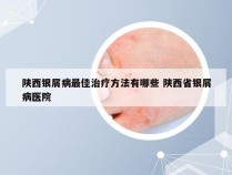 陕西银屑病最佳治疗方法有哪些 陕西省银屑病医院