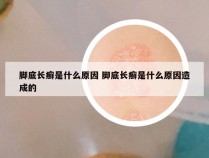 脚底长癣是什么原因 脚底长癣是什么原因造成的