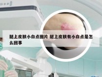 腿上皮肤小白点图片 腿上皮肤有小白点是怎么回事