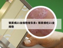 银屑病21金维他维生素c 银屑病吃21金维他