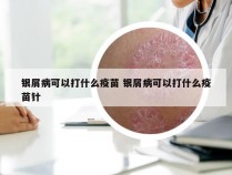 银屑病可以打什么疫苗 银屑病可以打什么疫苗针