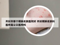 开封市那个朝鲜皮肤医院好 开封朝鲜皮肤科医院是公立医院吗