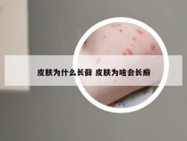 皮肤为什么长藓 皮肤为啥会长癣