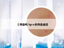 廯传染吗 hpⅴ的传染途径