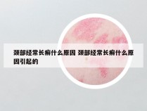 颈部经常长癣什么原因 颈部经常长癣什么原因引起的