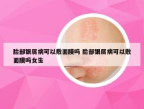 脸部银屑病可以敷面膜吗 脸部银屑病可以敷面膜吗女生