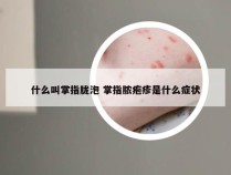 什么叫掌指胧泡 掌指脓疱疹是什么症状