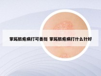 掌跖脓疱病打可善挺 掌跖脓疱病打什么针好