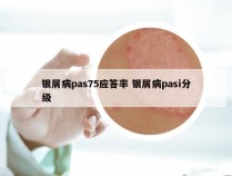 银屑病pas75应答率 银屑病pasi分级