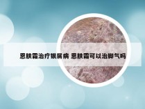 恩肤霜治疗银屑病 恩肤霜可以治脚气吗