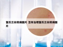 蟹爪兰白斑病图片 怎样治理蟹爪兰白斑病图片