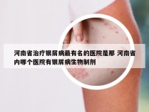 河南省治疗银屑病最有名的医院是那 河南省内哪个医院有银屑病生物制剂