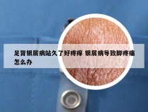 足背银屑病站久了好疼痒 银屑病导致脚疼痛怎么办