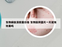 生物癣肽清胶囊价格 生物肽抑菌片一片就有效果吗