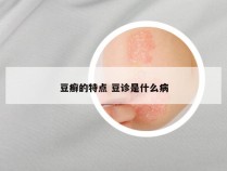 豆癣的特点 豆诊是什么病