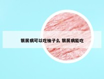 银屑病可以吃柚子么 银屑病能吃