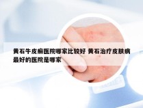 黄石牛皮癣医院哪家比较好 黄石治疗皮肤病最好的医院是哪家