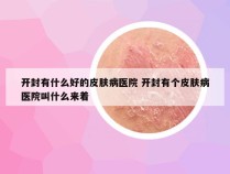 开封有什么好的皮肤病医院 开封有个皮肤病医院叫什么来着