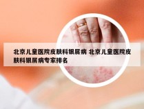 北京儿童医院皮肤科银屑病 北京儿童医院皮肤科银屑病专家排名