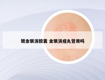 镀金银消胶囊 金银消痤丸管用吗