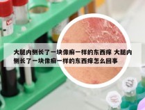 大腿内侧长了一块像癣一样的东西痒 大腿内侧长了一块像癣一样的东西痒怎么回事