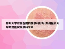 郑州大学附属医院的皮肤科好吗 郑州医科大学附属医院皮肤科专家