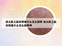 幼儿脸上起白斑是什么怎么回事 幼儿脸上起白斑是什么怎么回事啊