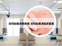 当归拈痛汤银屑病 当归拈痛汤临床医案