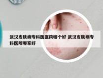 武汉皮肤病专科医医院哪个好 武汉皮肤病专科医院哪家好