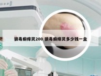 狼毒癣痒灵200 狼毒癣痒灵多少钱一盒