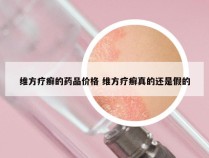 维方疗癣的药品价格 维方疗癣真的还是假的