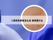 廯症状及表现怎么治 痱症是什么