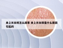 身上长白班怎么回事 身上长白斑是什么原因引起的