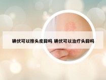 碘伏可以擦头皮藓吗 碘伏可以治疗头藓吗