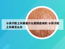 小孩子脸上长癣是什么原因造成的 小孩子脸上长癣怎么办