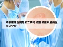 成都银康医院是公立的吗 成都银康银屑病医学研究院