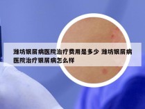 潍坊银屑病医院治疗费用是多少 潍坊银屑病医院治疗银屑病怎么样